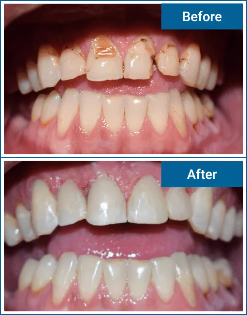 [:localization] thumbnail